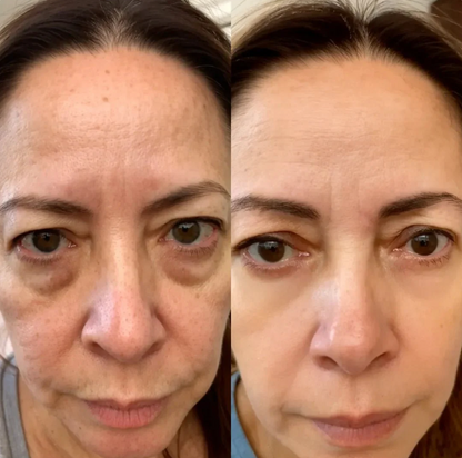 red light under eyes GlowNordic