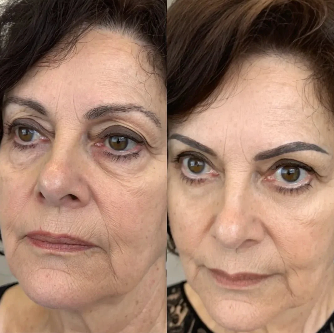 red light under eyes GlowNordic