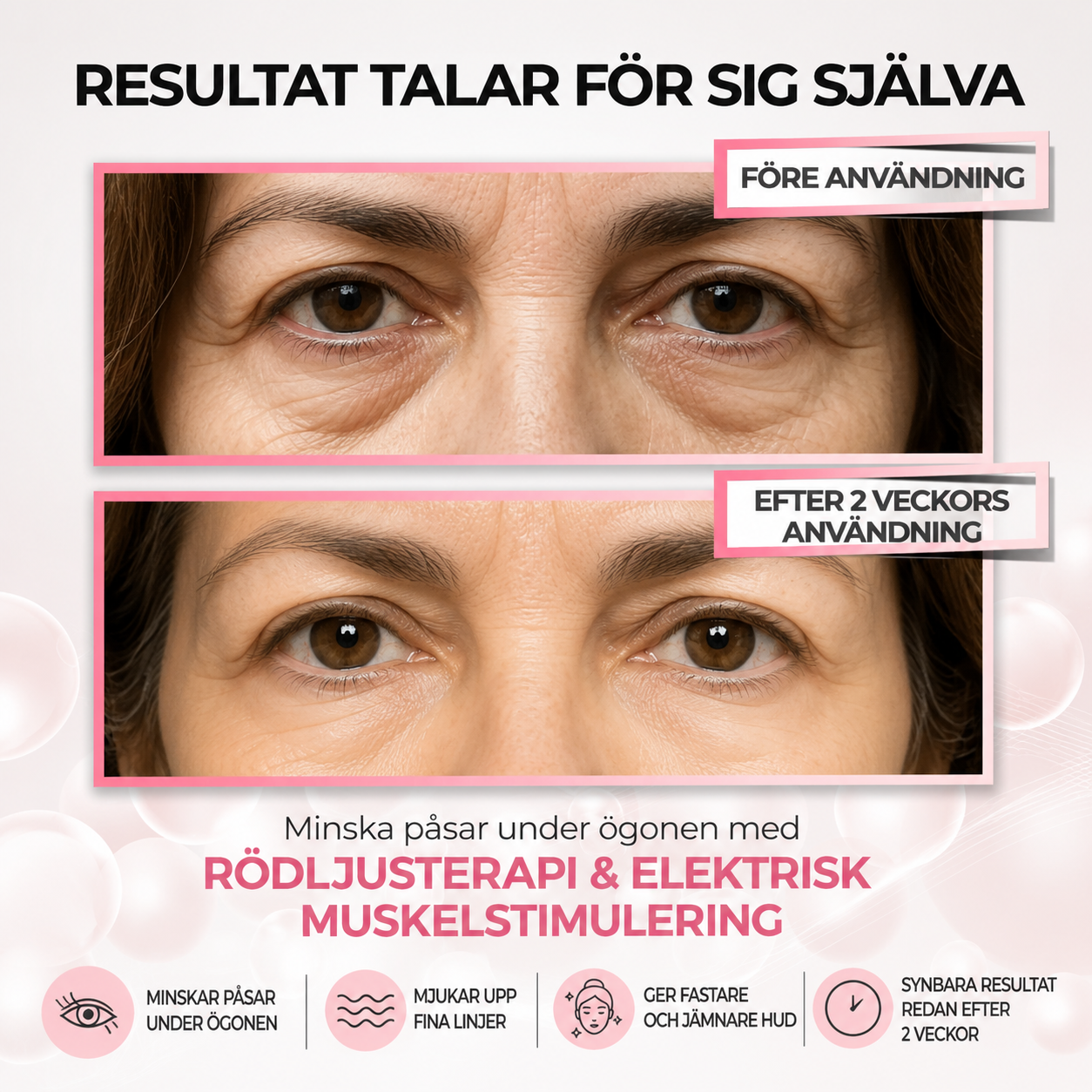 red light under eyes GlowNordic