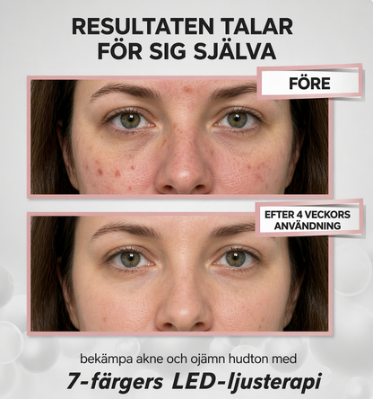 GlowNordic PRO LED-mask: 7-färgers ljusterapi GlowNordic