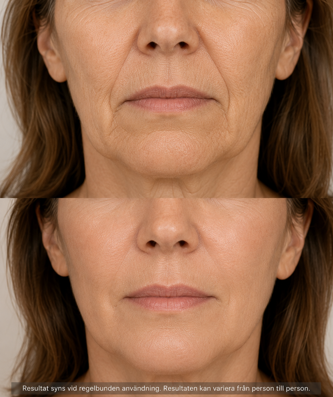 PDRN Collagen Balm Stick — Mot rynkor, linjer & slapp hud GlowNordic