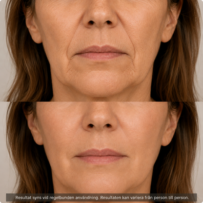 PDRN Collagen Balm Stick — Mot rynkor, linjer & slapp hud GlowNordic